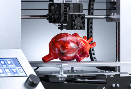 3D Printing in Healthcare